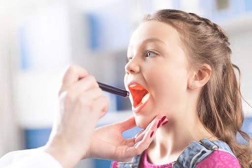 Dấu hiệu thường thấy của chứng viêm họng cấp ở trẻ em do vi khuẩn là mảng trắng phía sau cổ họng